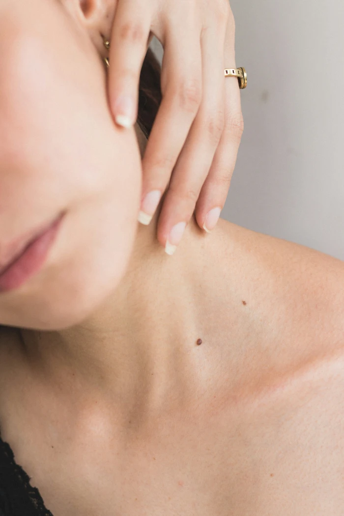 biorevitalizacija-fileri-botoks-dr-maja-kepeska-24-bonjour-ba