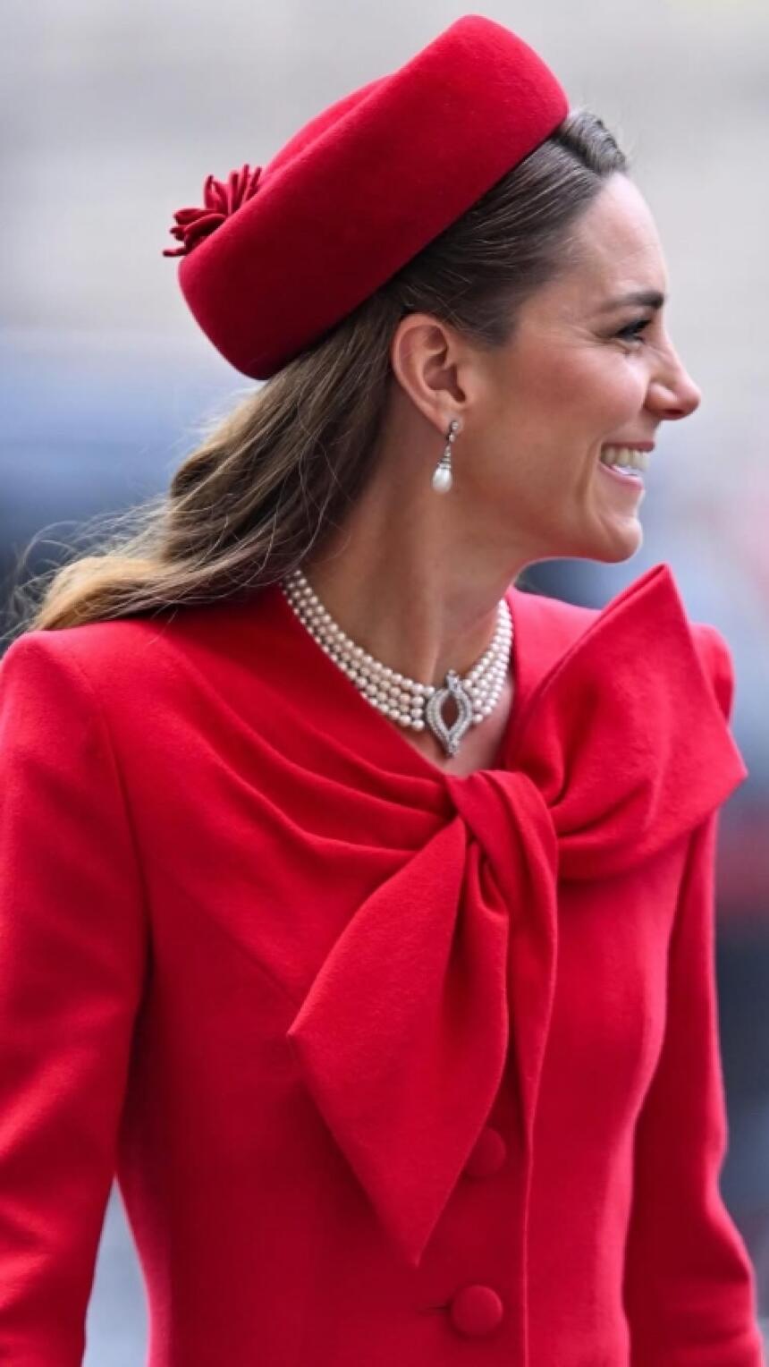 Znate li ovo? Ulje za kožu (i rast kose) kojem je Kate Middleton vjerna već 20 godina.