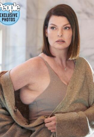 Supermodel Linda Evangelista otvoreno o kozmetičkoj proceduri koja je promijenila njezin izgled
