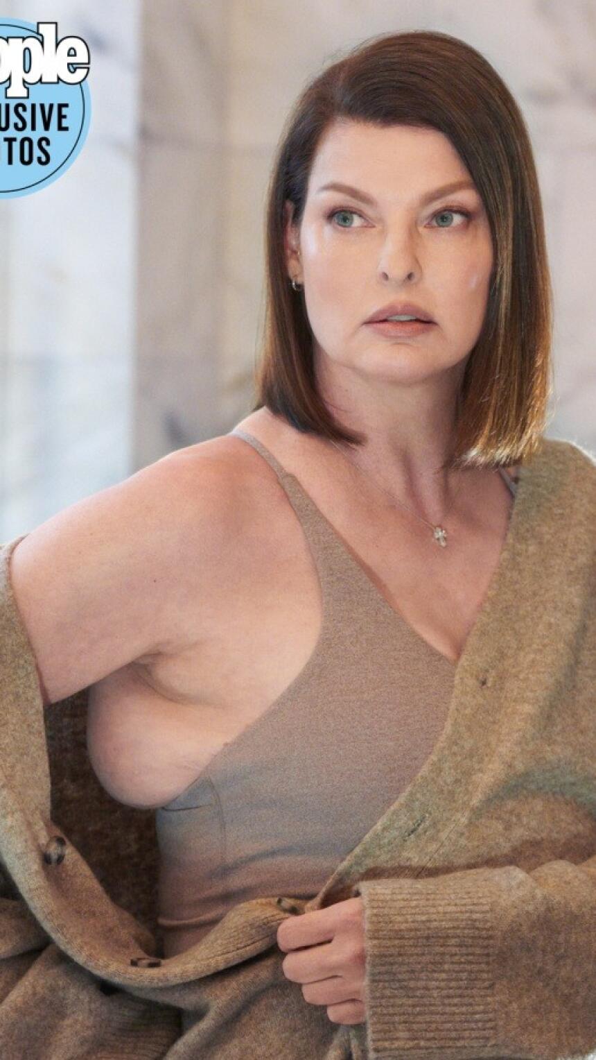 Supermodel Linda Evangelista otvoreno o kozmetičkoj proceduri koja je promijenila njezin izgled