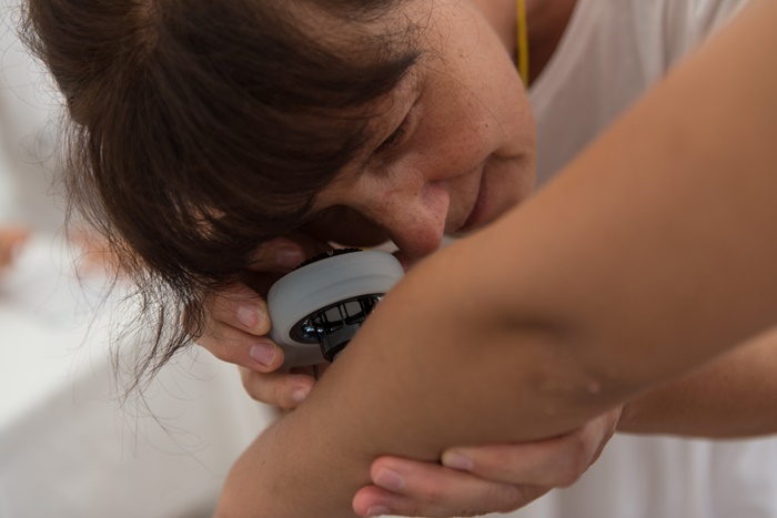 Besplatni dermatološki pregledi:  Na Vilsonovom šetalištu u Sarajevu u organizaciji dm-a