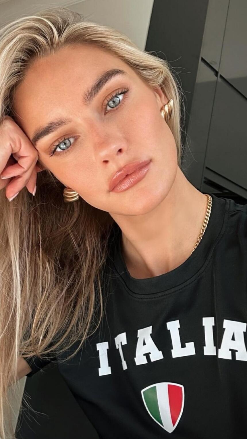 Face taping: Sve što trebate znati o tehnici koja je zamijenila botox
